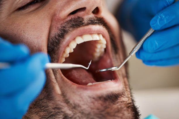 Best Sedation Dentistry  in Hutchins, TX